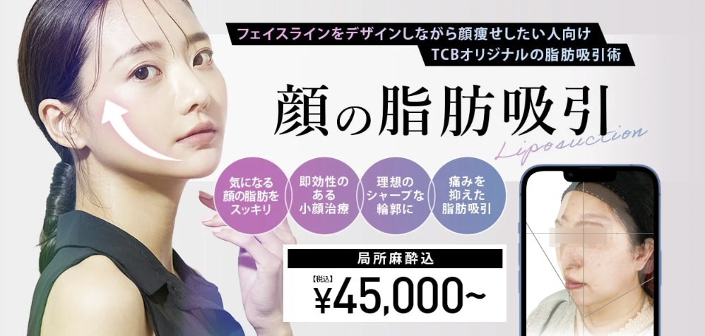 顔の脂肪吸引